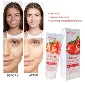 Tomato Peeling Gel | ISO Approved | 100% Authentic | Brightening Face & Body Exfoliating Gel 320 ml